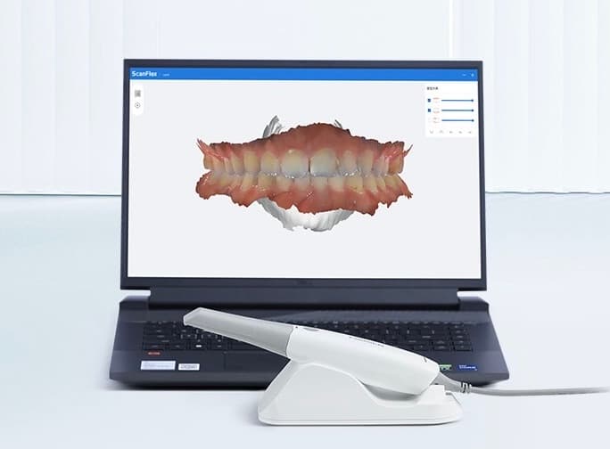 Intraoral Scanner สแกนช่องปาก 3 มิติ